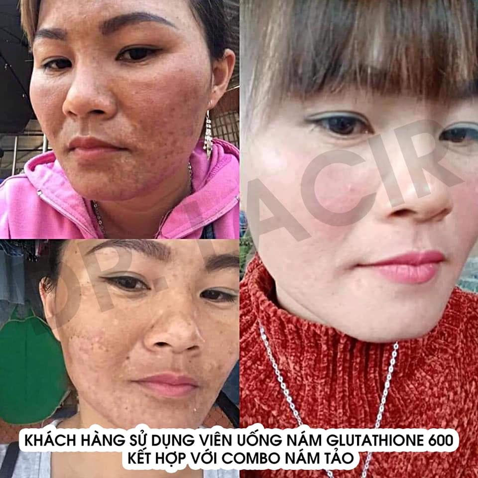 [HCM]Combo Nám Tảo Lamer Care - Dr. Lacir