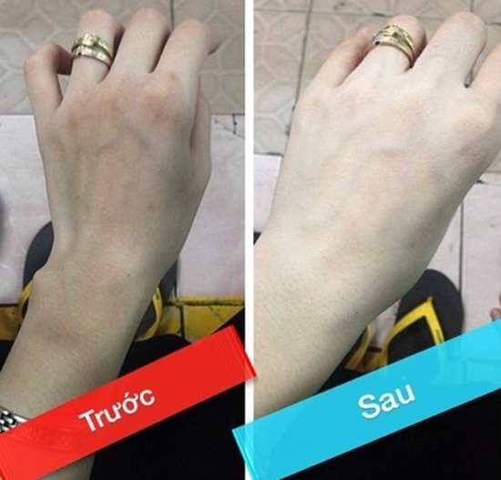 Kem tắm trắng TRĂNG 16 Hằng Nga