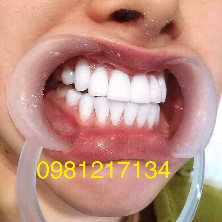 đèn chiếu phủ bóng răng biox..phủ trám răng sứ xinh học