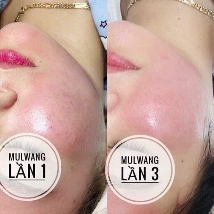 Tế bào gốc Mulwang X5 căng bóng trắng sáng da