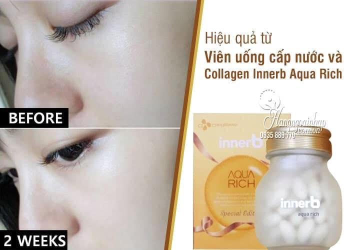 VIÊN UỐNG CẤP NƯỚC INNERB AQUA RICH