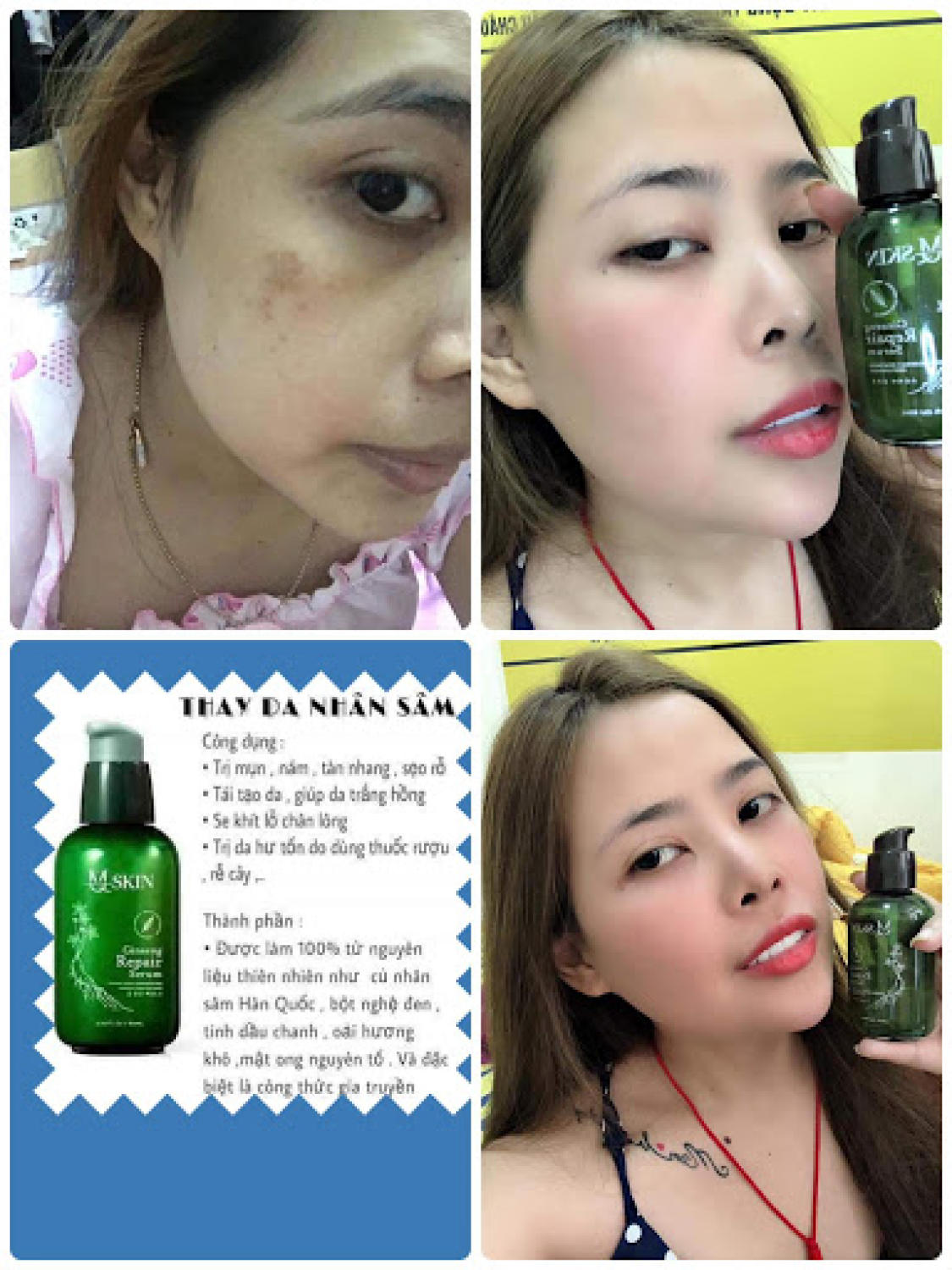 Combo Kem Face Nhân Sâm MQ Skin + Serum Thay Da