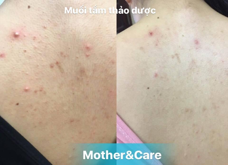 Muối tắm thảo dược Mother & Care