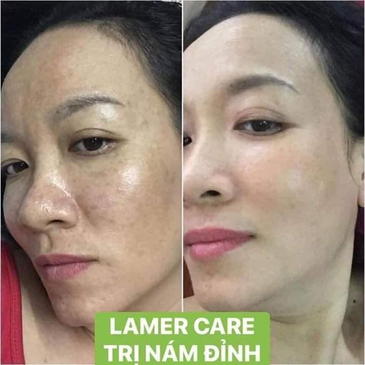 [HCM]Combo Nám Tảo Lamer Care - Dr. Lacir