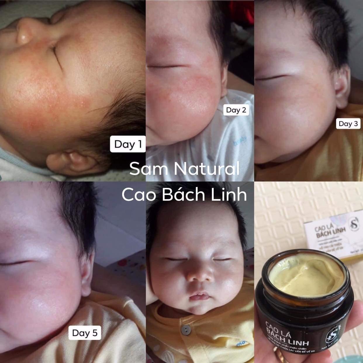 CAO LÁ BÁCH LINH SAM NATURAL