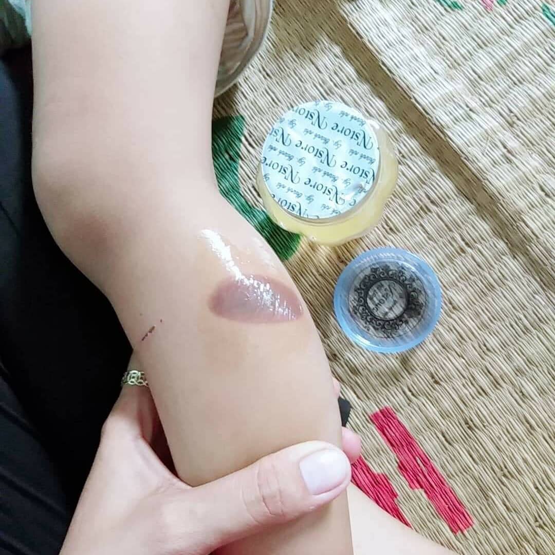 Mỡ Trăn N'STORE