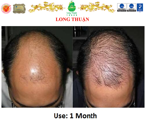 Tinh Dầu Hoa Bưởi Long Thuận Loại 2 - Chai 80ml