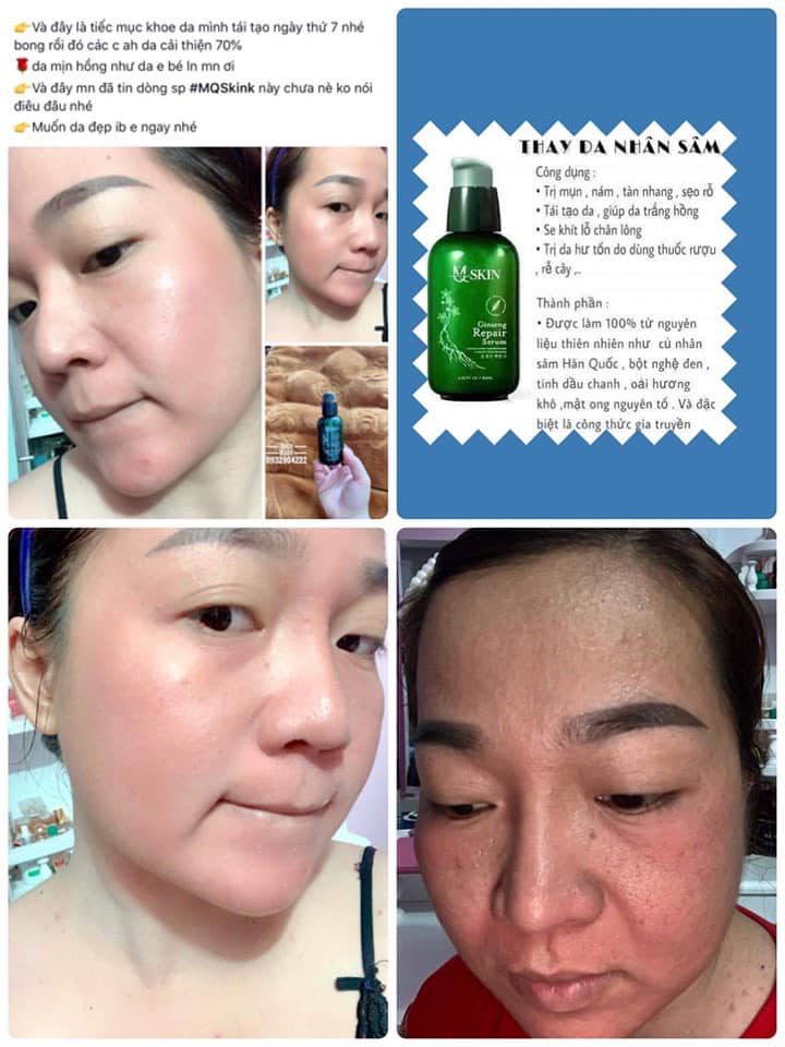 [HCM]SERUM THAY DA NHÂN SÂM MQ SKIN