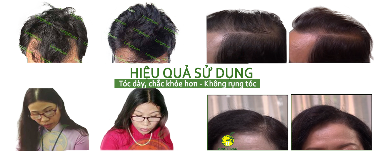 Tinh Dầu Hoa Bưởi Loại 2 - Long Thuận