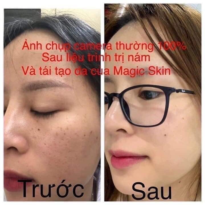 Cao Nám MagicSkin
