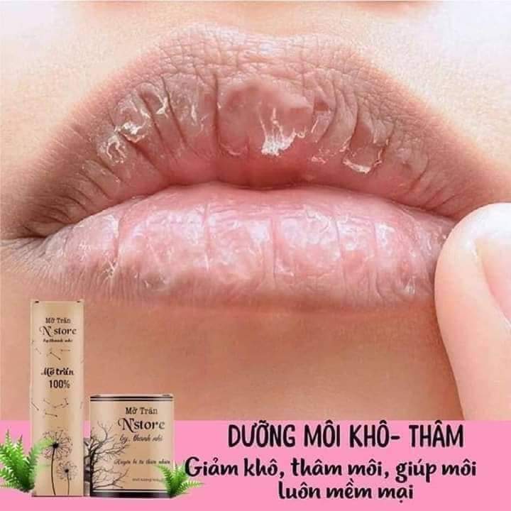 Mỡ Trăn N'STORE