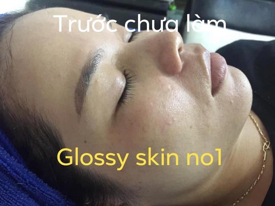 PRF + glossy skin no1
