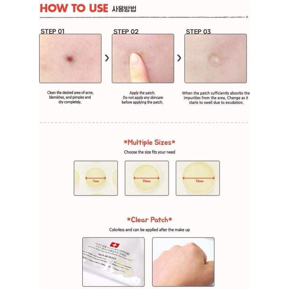 [HCM]Miếng Dán Mụn Cosrx Acne Pimple Master Patch