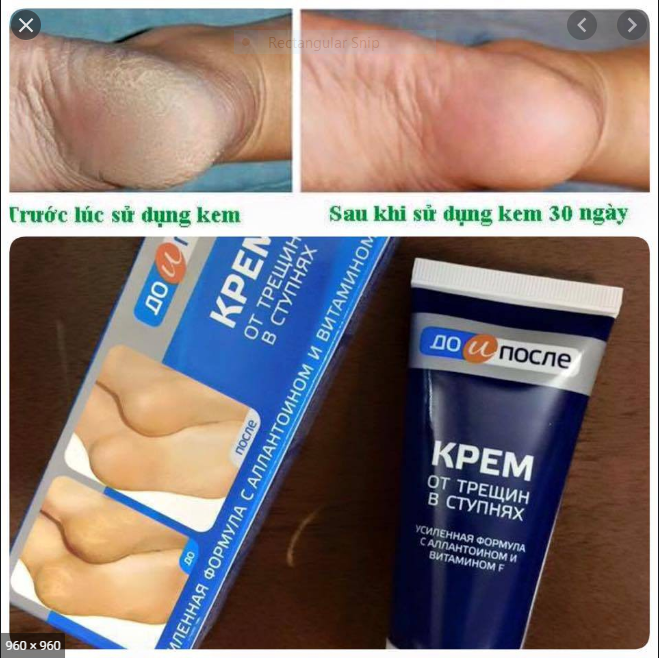 Kem tri nứt gót chân KPEM Nga