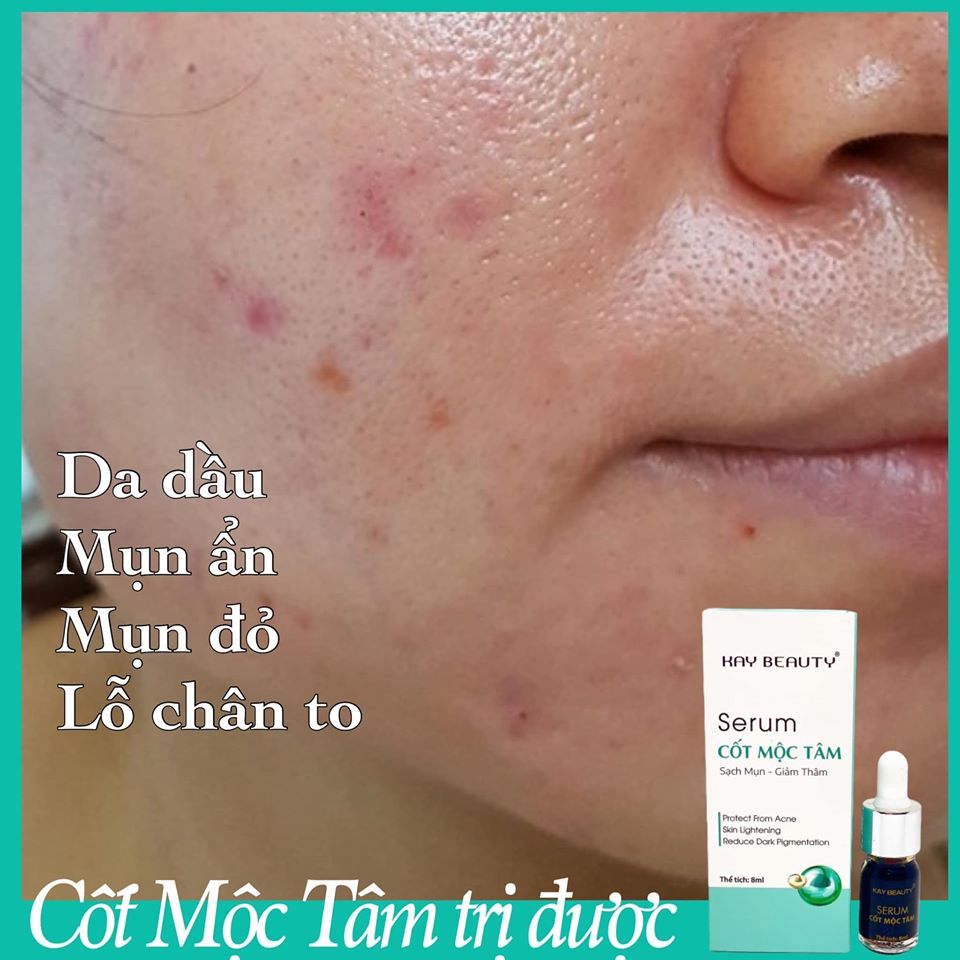 Serum Cốt Mộc Tâm Kay Beauty 8ml