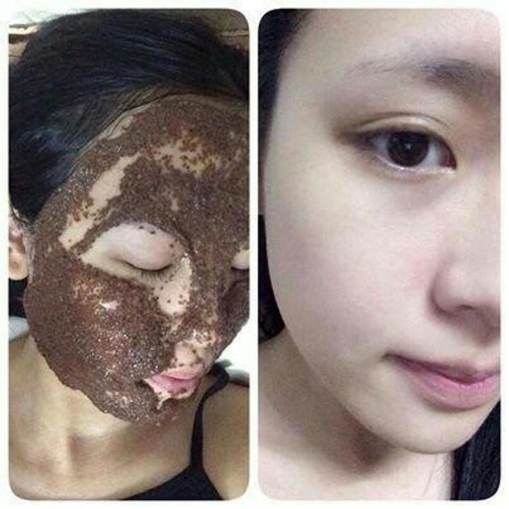 [HCM]Ngũ Hoa Hạt 100 Gram - Trị Mụn Ẩn Dịu Da