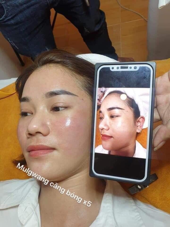 Tế bào gốc Mulwang X5 căng bóng trắng sáng da