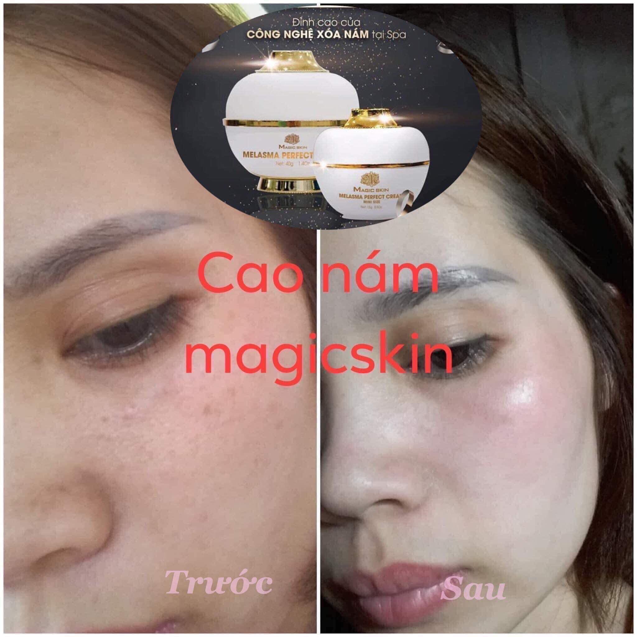 Cao Nám MagicSkin