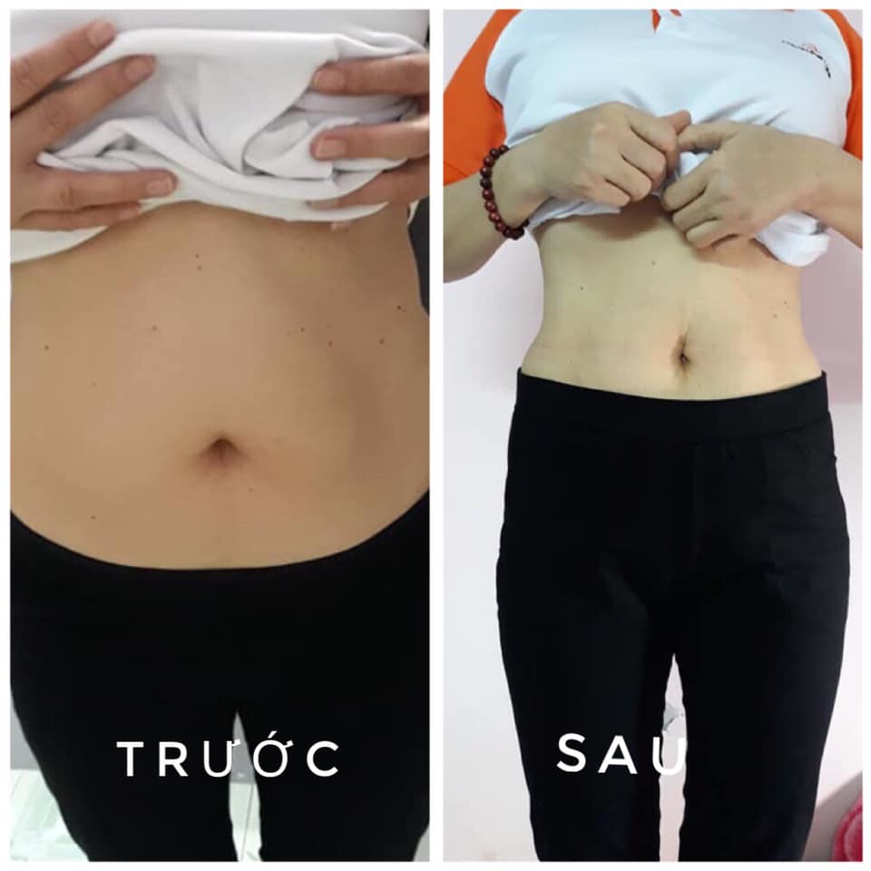 Đai Gen Nịt Bụng PERFECT EO Giảm Eo,Tan Mỡ Bụng, Vòng Eo Hoàn Hảo 60, 3 Đai Thông Minh. Free Ship