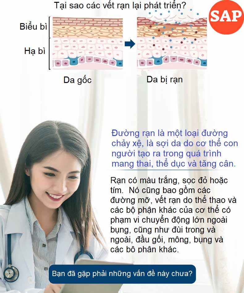 Kem Hết Rạn Da, Hết Sẹo Hiệu Quả Treatment Body Cream Thương Hiệu VIBRANT GLAMOUR Làm Trắng Và Săn Chắc Mịn Mượt Chống Lão Hóa