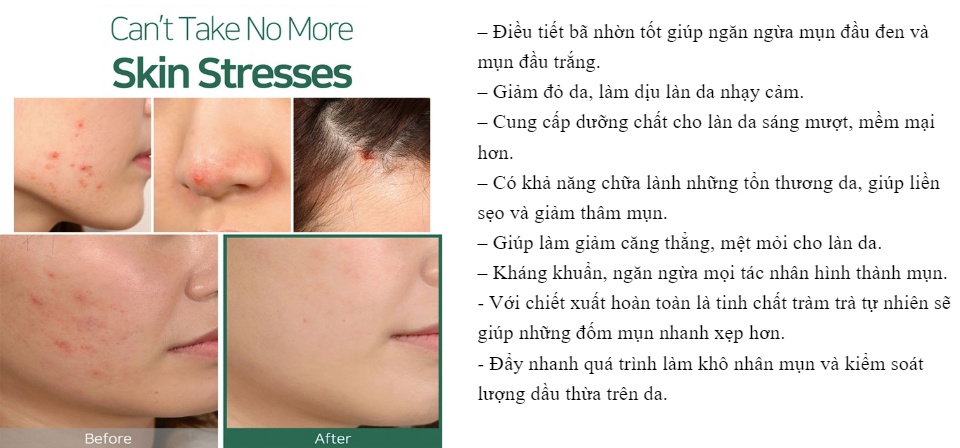 Tinh Dầu Tràm Trà Giảm Mụn Some By Mi 30 Days Miracle Clear Spot Oil (10ml) 5