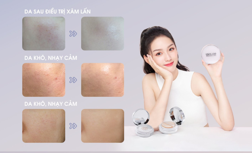 Cushion Usolab Recovery Balm SPF25+++ 15g