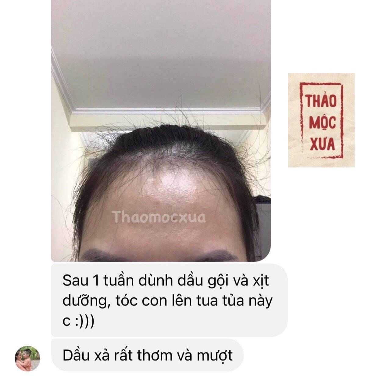 Dầu Gội Bồ Kết Thảo Dược Kích Thích Mọc Tóc Ngăn Rụng Tóc Giảm Ngứa Gàu Thảo Mộc Xưa Organic 500ml Hiệu Quả Sau 7 Ngày Miquala