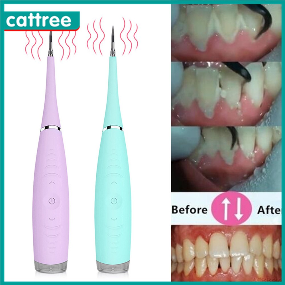 Máy lấy cao răng Siêu âm cao cấp, Dụng cụ lấy cao răng mini , Bộ dụng cụ lấy cao răng tại nhà, Máy lấy cao răng cao cấp Sử Dụng Sạc 3 Chế Độ Rung Loại Sạch Mảng Bám, Cao Răng vết ố răng