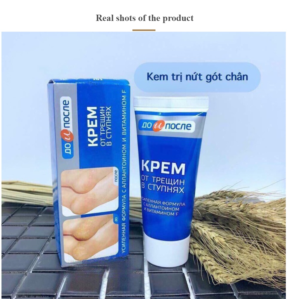 Kem mờ nứt gót chân Nga Kem làm liền vết nứt chân tay Kem dưỡng da làm mềm da 7