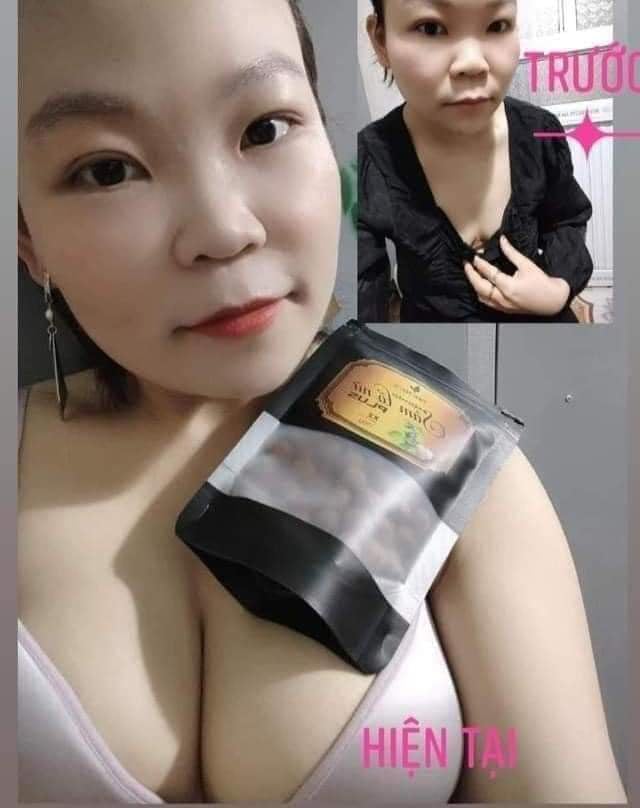 Kẹo mầm sâm tố nữ plus X2 thảo mộc 37 nở ngực siêu tốc HNBEATY