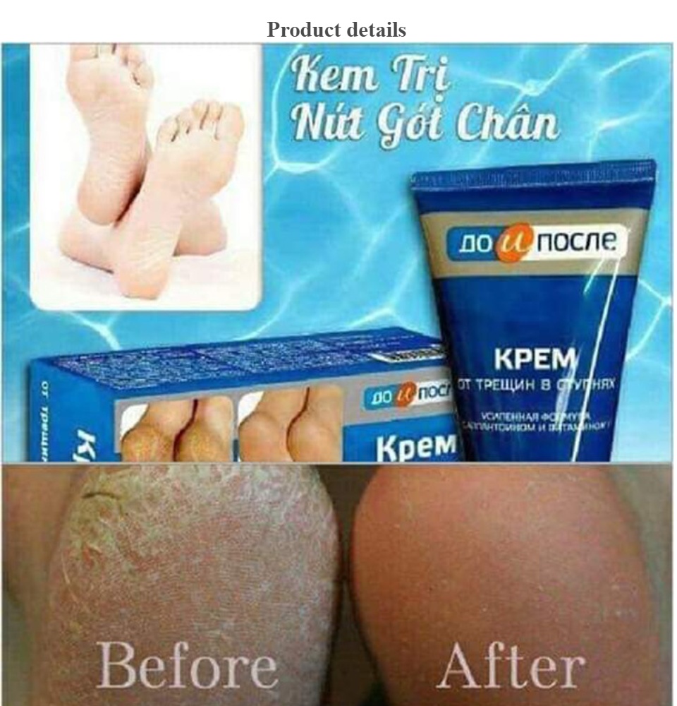 Kem mờ nứt gót chân Nga Kem làm liền vết nứt chân tay Kem dưỡng da làm mềm da 5