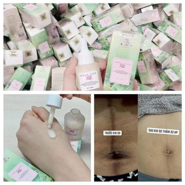 Serum khử thâm X2 Huyền Phi chính hãng, tri thâm nách, mông, bẹn, body cho da trắng sáng tự nhiên
