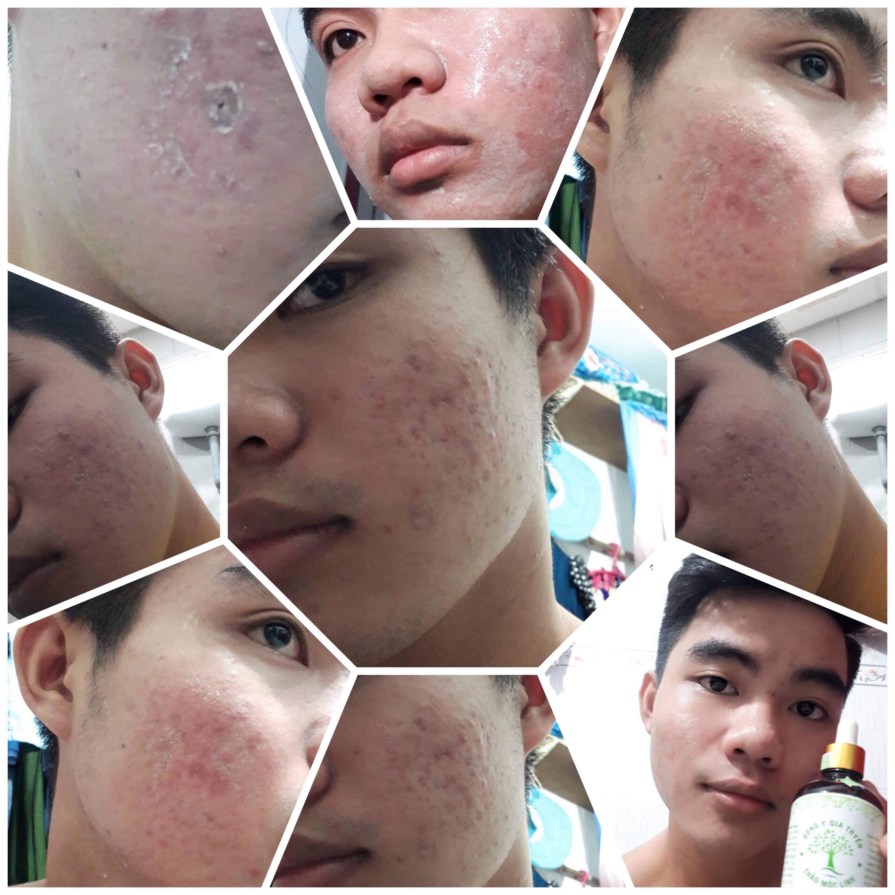 Đông Y Thảo Mộc Linh