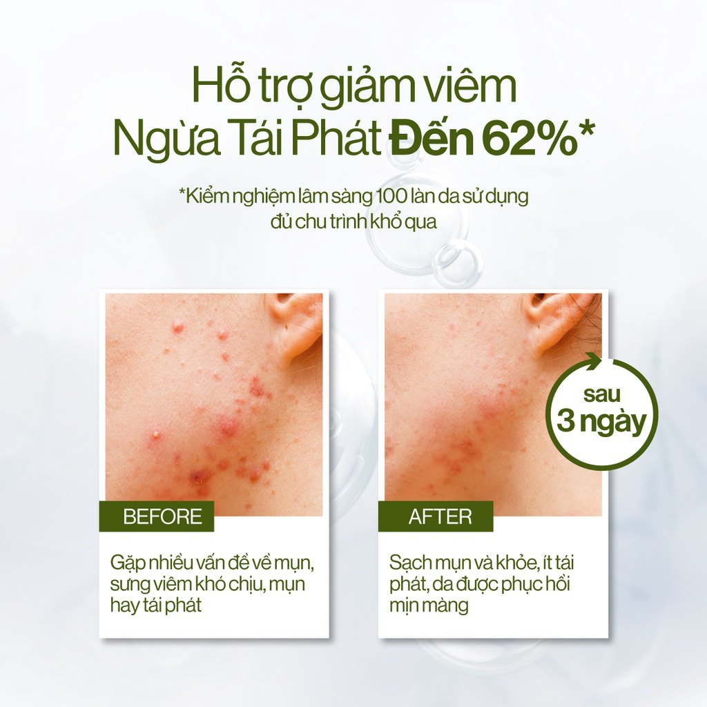 Bộ 4 Sản Phẩm làm sạch, giảm mụn, ngừa thâm & ngăn ngừa mụn tái phát GILAA BITTER MELON BLEMISH REPAIR