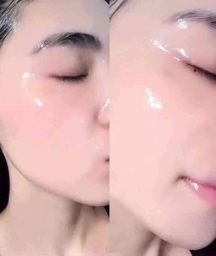 KEM DƯỠNG TRẮNG DA TÁI TẠO BAN ĐÊM SU SKIN YODY WHITE PHƯƠNG ANH