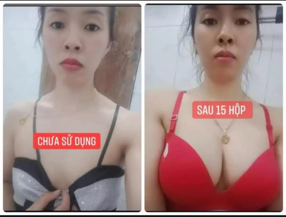 Kẹo mầm sâm tố nữ plus X2 thảo mộc 37 nở ngực siêu tốc HNBEATY