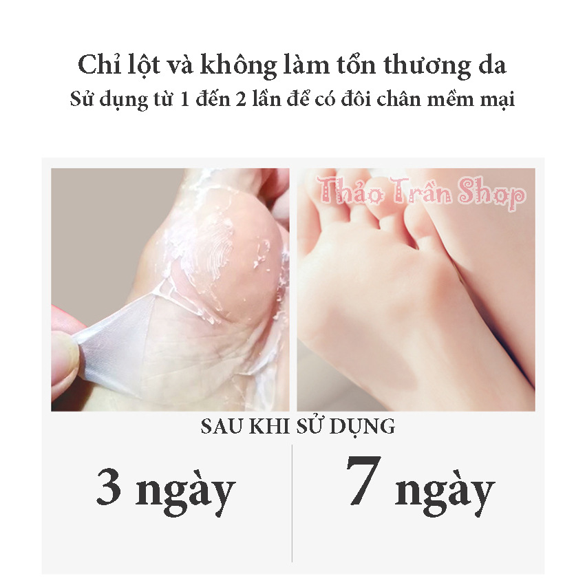 10 cách chăm sóc da chân mịn như da em bé