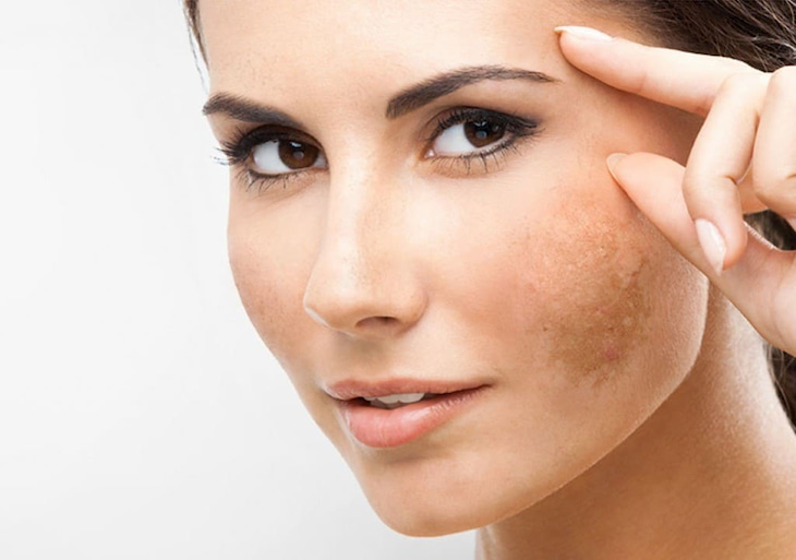 VIÊN NGHỆ - MẬT ONG- HOA CÚC 30 Túi Nhỏ Giảm Nám Da, Đẹp Da, Giảm Đau Dạ dày Hiệu quả, Trà Đông Y Việt