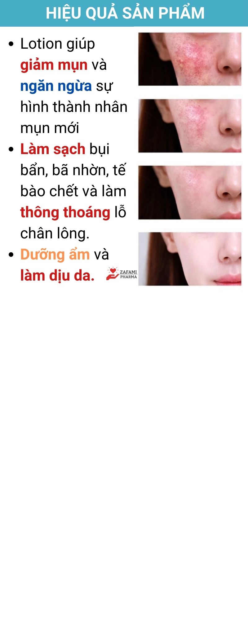 Chấm mụn Fixderma Salyzap kem chấm mụn, tẩy tế bào chết, đánh bay mụn ẩn, mụn đầu đen, giảm thâm da mụn, có thể thay thế chấm mụn neogen, differin, miếng dán mụn (20ml) - Zafami Pharma