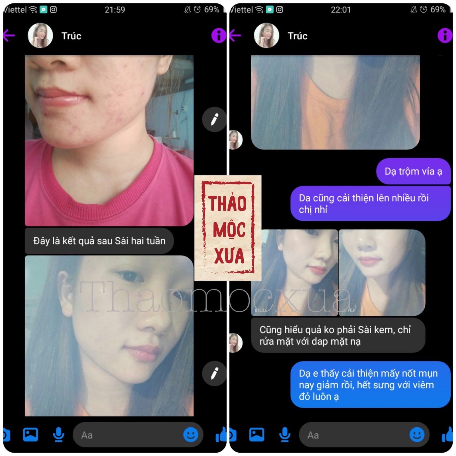 Mặt Nạ Giảm Mụn Diếp Cá Thảo Mộc Xưa - Cấp Ẩm, Ngừa Mụn Sạm Nám, Se Khít Lỗ Chân Lông, Dành Cho Da Dầu Mụn, 100% Thiên Nhiên, An Toàn Cho Mẹ Bầu - Tặng Cọ Đắp Mặt Nạ | 50gr - Miquala