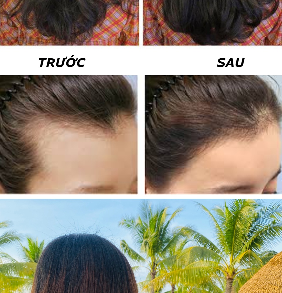 [hcm]tinh dầu bưởi xịt mọc tóc pomelo emer 100ml nuôi dưỡng tóc từ gốc đến ngọn giảm rụng tóc kích mọc tóc nhanh hơn gấp 2 đến 3 lần 16