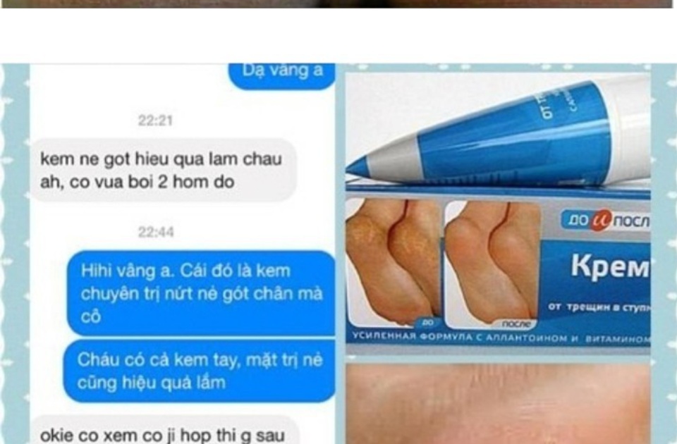 Kem mờ nứt gót chân Nga Kem làm liền vết nứt chân tay Kem dưỡng da làm mềm da 6