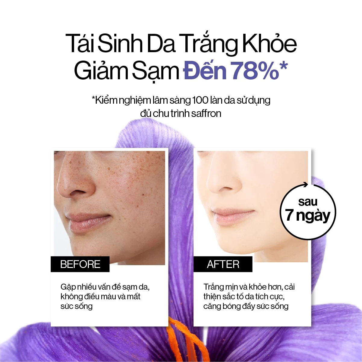 Bộ 4 sản phẩm dưỡng da Gillaa / Bộ dưỡng trắng  Gilaa Saffron Tone Up Repair / Bộ xoá mụn Gilaa Blemish Repair