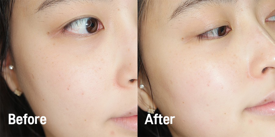 Sữa Rửa Mặt Trà Xanh Ngừa Mụn Benew Green Tea Foam Cleansing 100ml, Không Gây Kích Ứng Phù Hợp Mọi Loại Da.