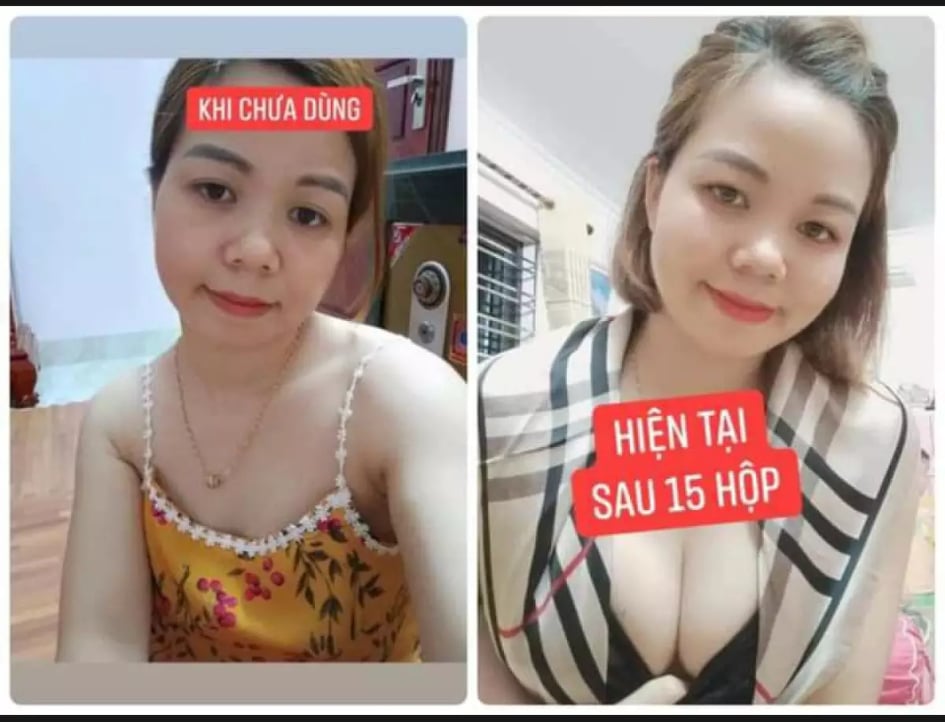 Kẹo mầm sâm tố nữ plus X2 thảo mộc 37 nở ngực siêu tốc HNBEATY