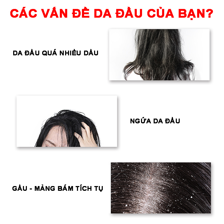 Tẩy da chết cho tóc và da đầu JIORNIEE Hana Tech hũ 250ml - Sạch Gàu, Kiềm Soát Dầu Thừa, Tóc Không Còn Bết Dính - Tẩy tế bào chết da đầu, tẩy tế bào chết tóc, tẩy da chết đầu, tẩy tế bào chết cho da đầu - Hanatech