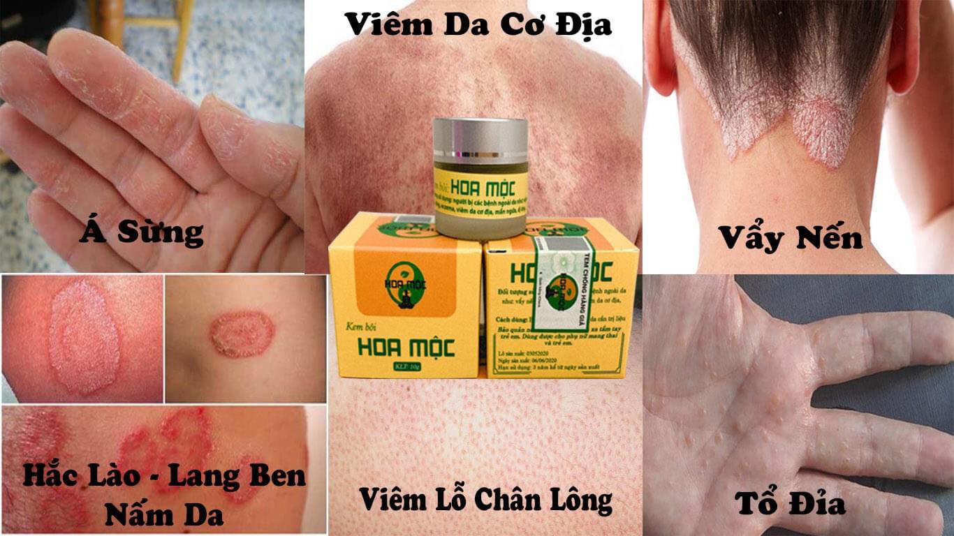 Kem Bôi Da Liễu Hoa Mộc Hàng Chuẩn Hũ 20gr