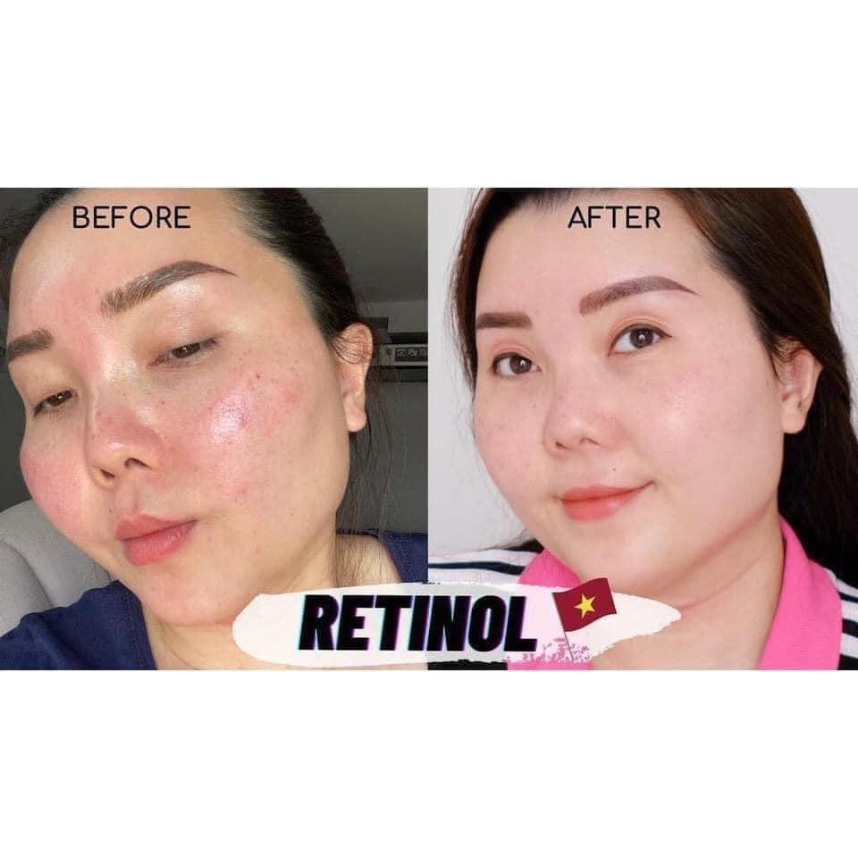 KEM DƯỠNG DA ĐỈNH CAO RETINOL X5 ELASTIN CREAM SKINPASTEL 30ML CHỐNG NHĂN, CHỐNG LÃO HÓA, MỸ PHẨM HÀN QUỐC CHÍNH HÃNG
