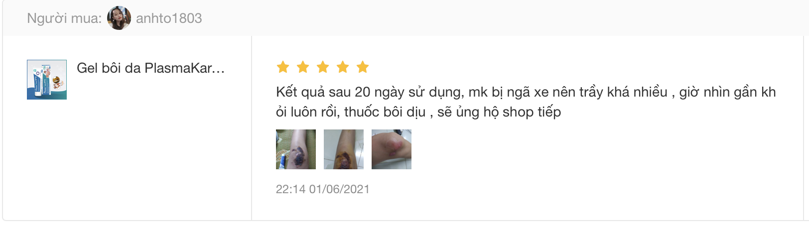 Gel bôi Nano Bạc PlasmaKare No5 kháng khuẩn, kháng nấm, virus...chống viêm, giảm ngứa, tái tạo da, chuyên sâu cho bệnh về da