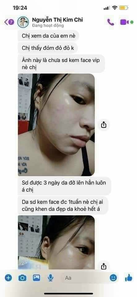 Kem VIP FACE NHÂN SÂM (MẪU MỚI PHIÊN BẢN 2021) giúp đánh bay nám tàn nhang trắng da ngừa lão hóa TẶNG BĂNG ĐÔ +GẤP TÓC